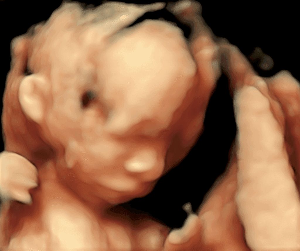 胎児超音波検査　超音波検査　NIPT検査