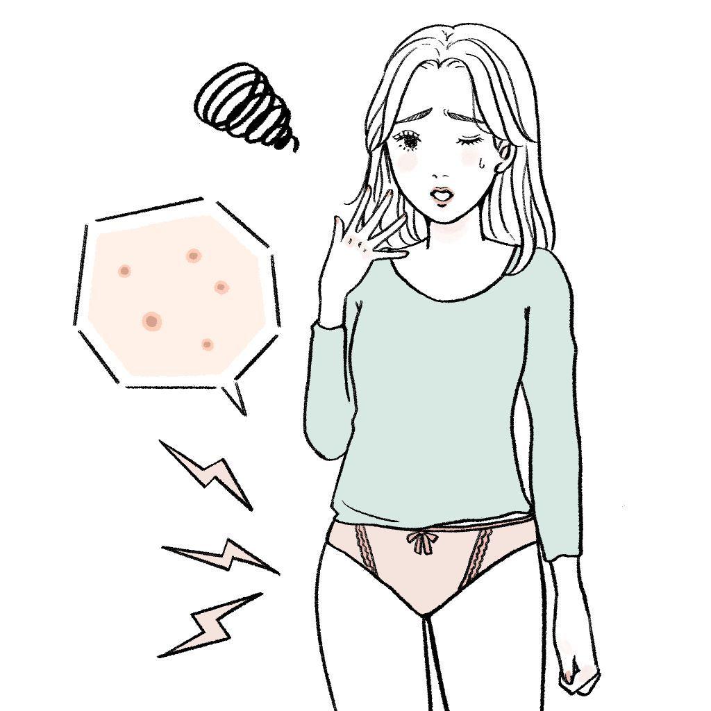 デリケートゾーン　かゆみ