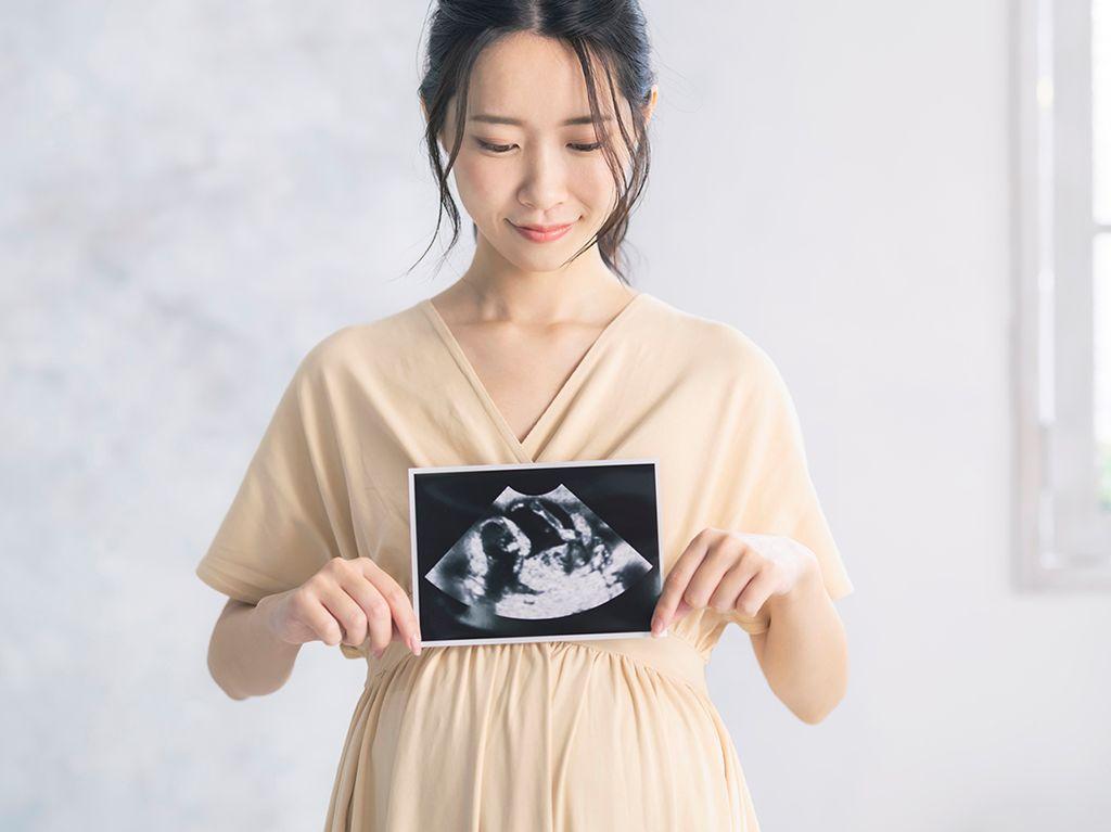 女性　妊婦　エコー写真　出生前診断