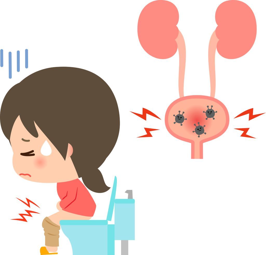 漢方薬 東洋医学 膀胱炎