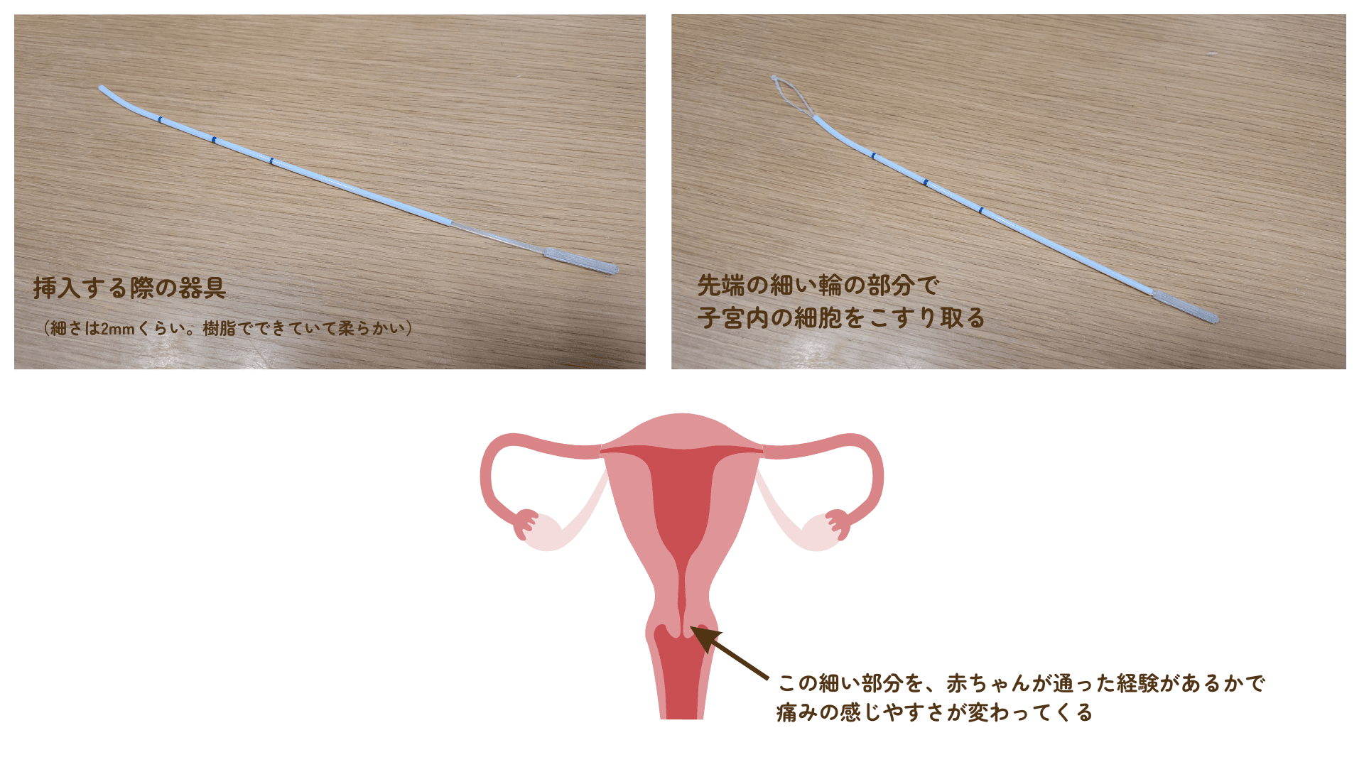 細胞を採取する器具と子宮
