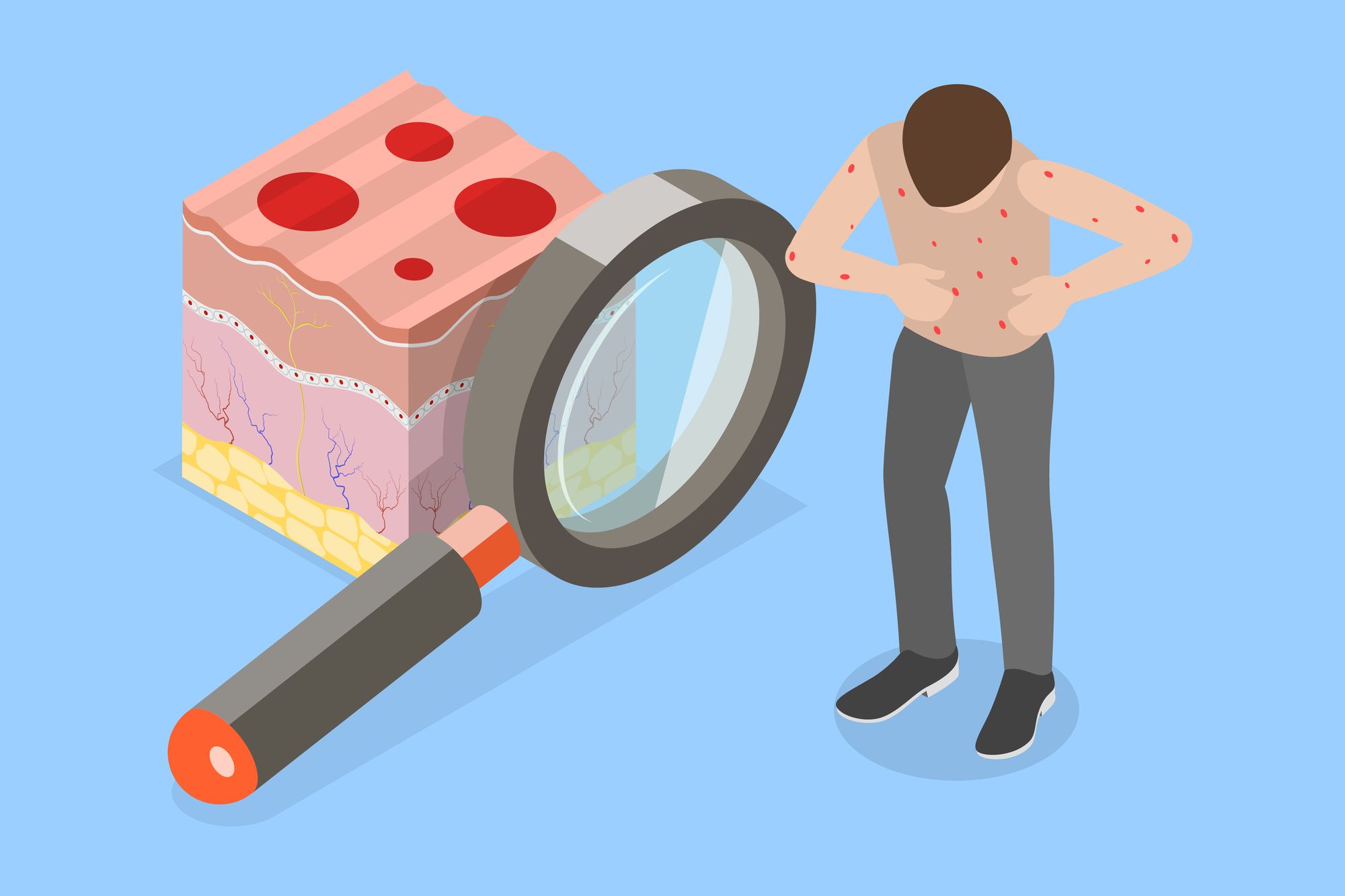 天然痘にかかって体にぶつぶつができた人のイラスト
