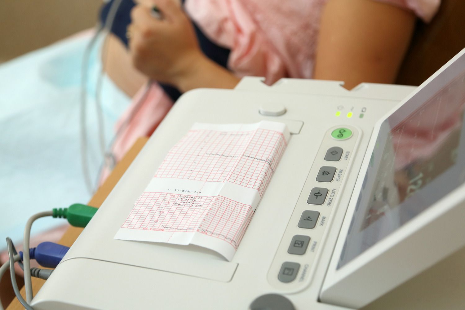 出産　分娩　AI