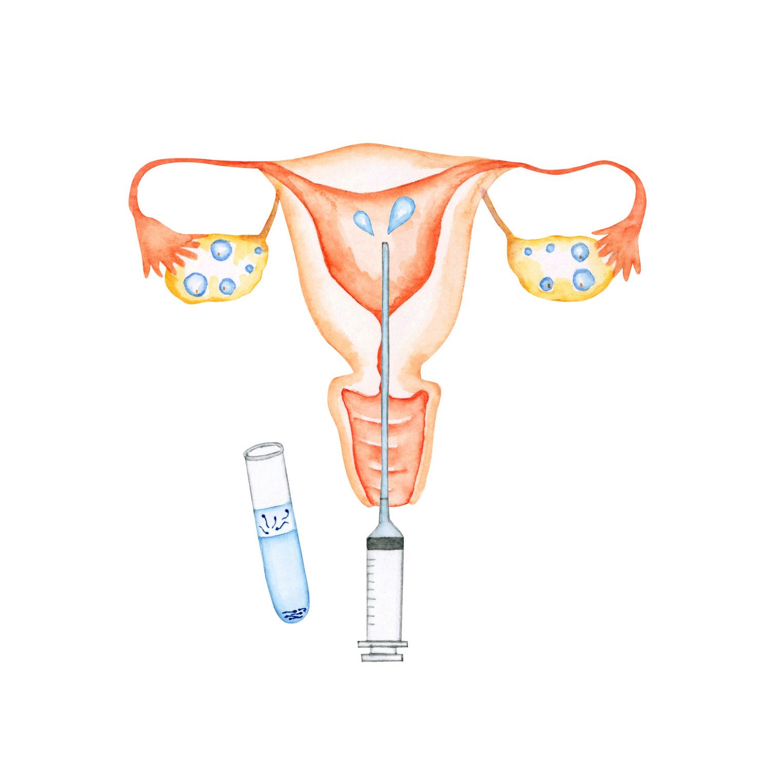 不妊治療　体験談　人工授精