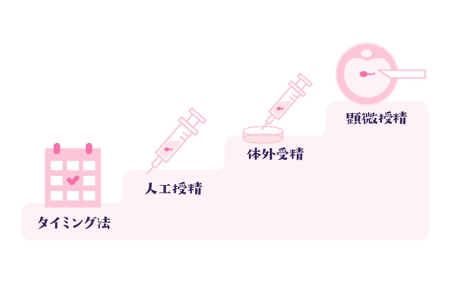 不妊治療　ステップアップ　ステップダウン