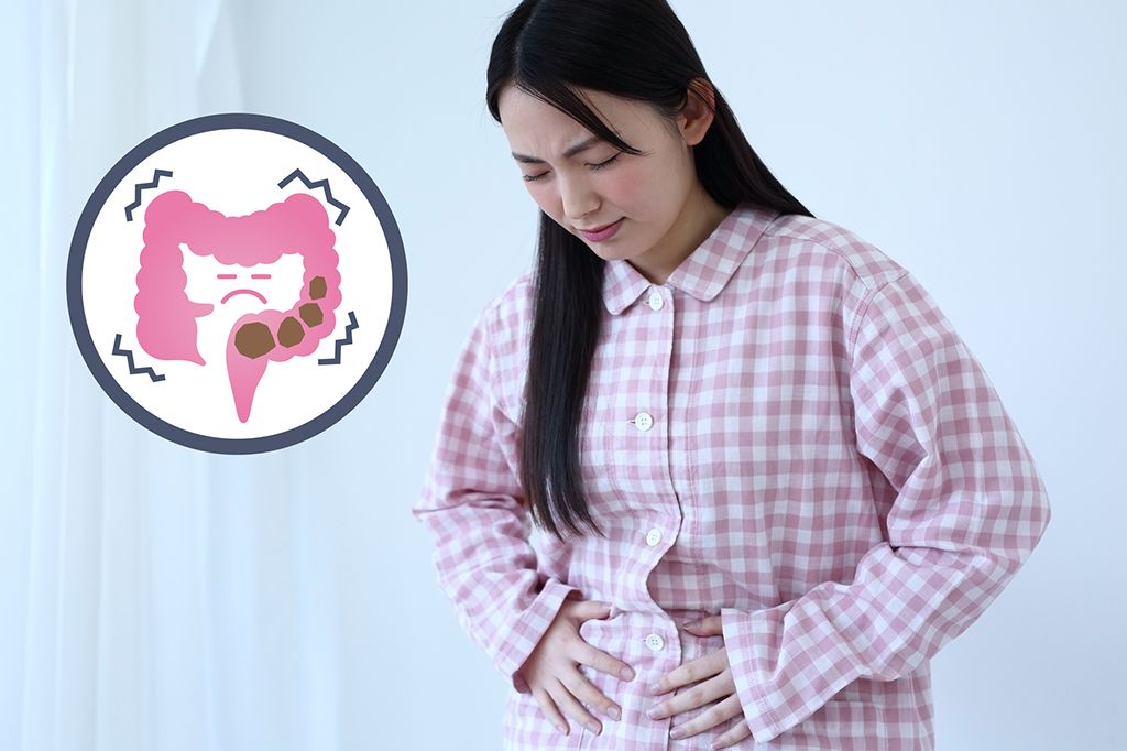 女性 便秘 腹痛