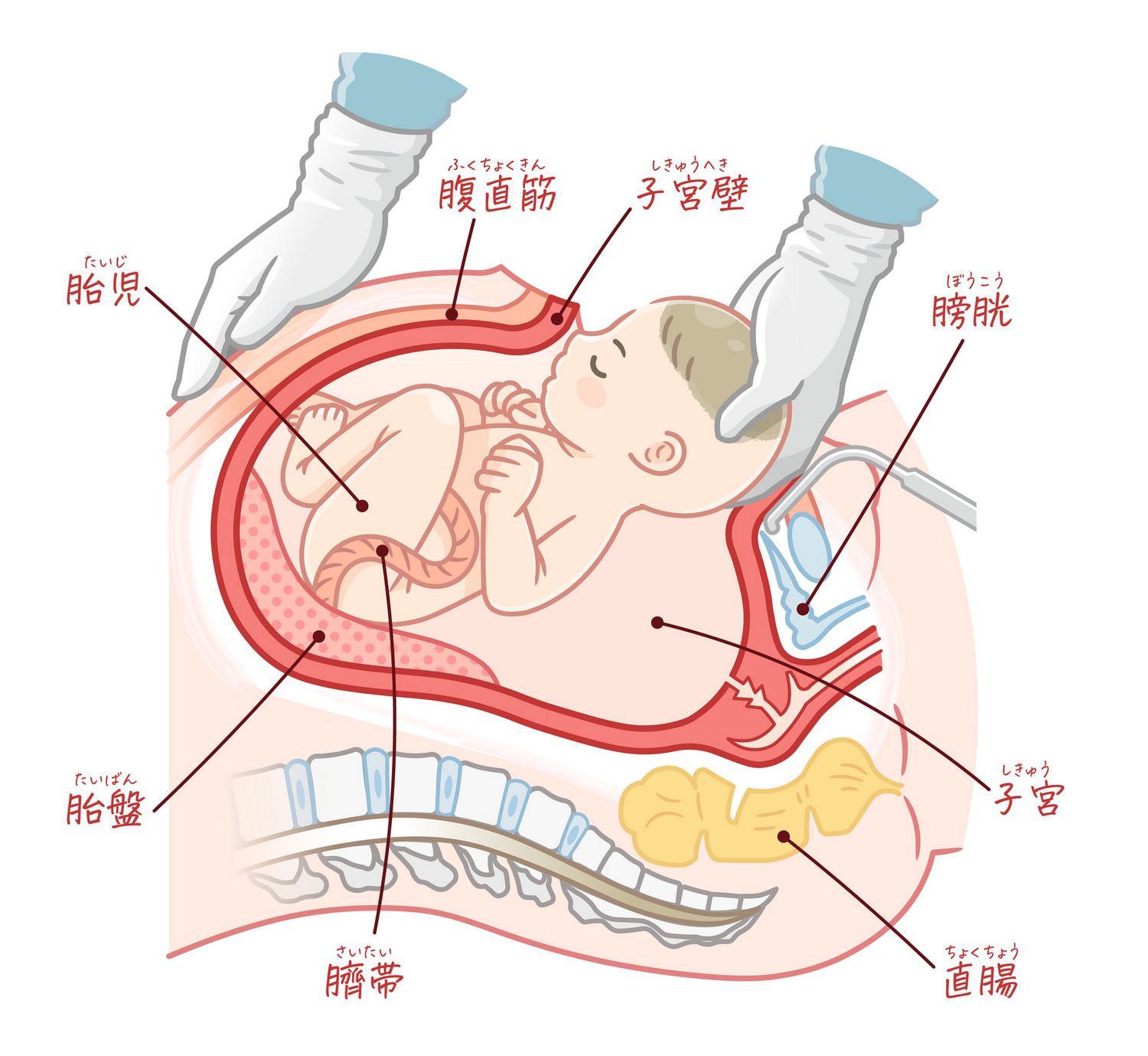 出産　分娩　帝王切開