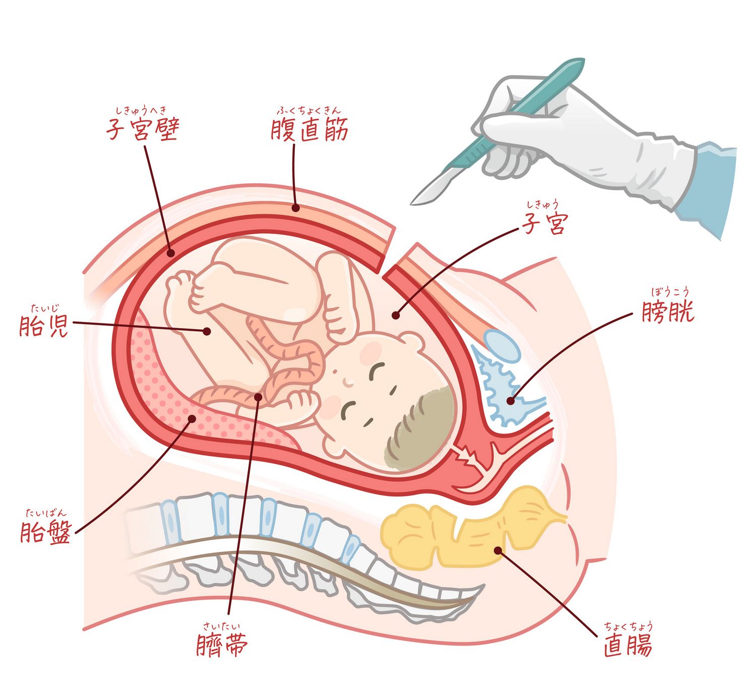 出産　分娩　帝王切開　理由