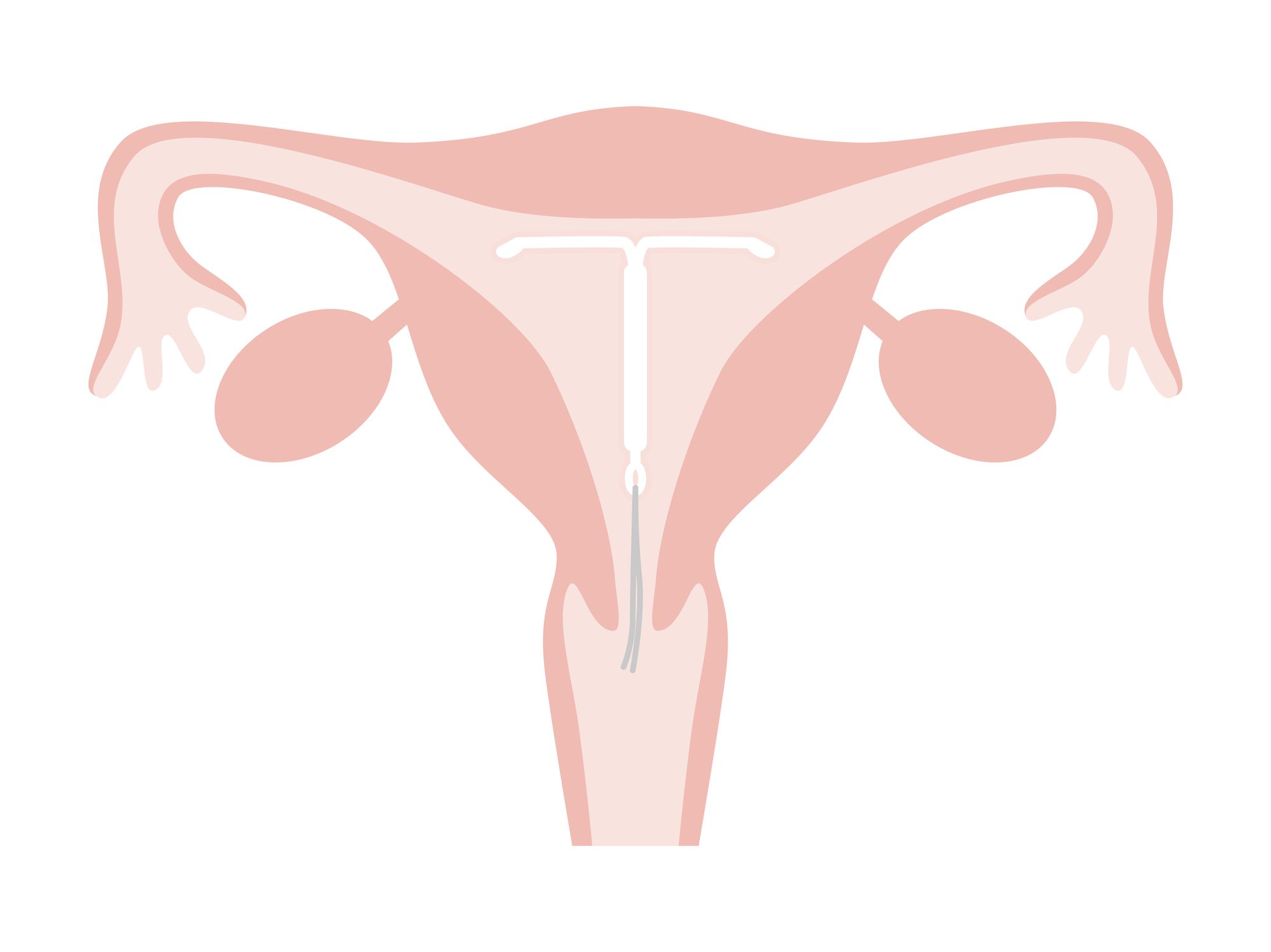 ミレーナのイラスト